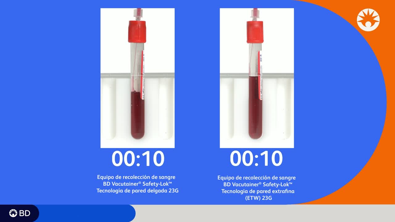 Representación visual de flujo: pared fina 23G y pared extrafina ETW 23G